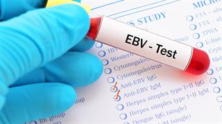 Ερευνητές αναπτύσσουν εμβόλιο κατά του ιού Epstein-Barr