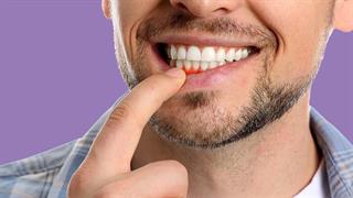 Φάρμακο για τον διαβήτη στη μάχη κατά της περιοδοντίτιδας [μελέτη]