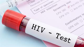 CDC: Ανθρωποι με HIV έχουν υψηλότερο κίνδυνο επαναλοίμωξης από COVID