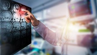 Ποια νοσοκομεία θα στηρίξουν την ανάπτυξη δικτύου κέντρων εγκεφαλικού επεισοδίου