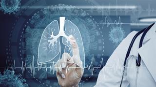 Νέα θεραπευτική στρατηγική για τον καρκίνο του πνεύμονα [μελέτη]