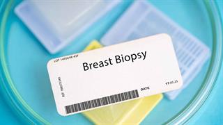 Η αξία της προεγχειρητικής διάγνωσης στον καρκίνο του μαστού