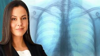 Υπάρχει κληρονομικότητα στον καρκίνο του πνεύμονα;