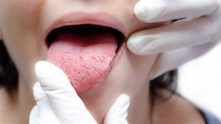 Τι λέει η γλώσσα μας για την υγεία μας;