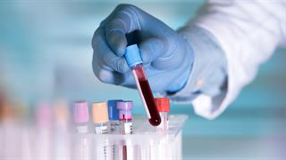 Αναπτύχθηκε εξέταση αίματος που θα μπορούσε να προβλέπει την επιδείνωση της πολλαπλής σκλήρυνσης [μελέτη]