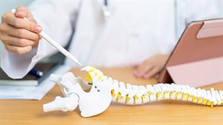 Οριστική αντιμετώπιση της κύστης κόκκυγος με την ενδοσκοπική τεχνική EPSiT