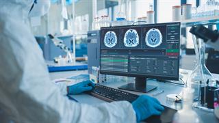 Ερευνητές ανακάλυψαν τρόπο αναστροφής της εγκεφαλικής γήρανσης λόγω COVID-19