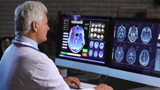 Το κάπνισμα συρρικνώνει τον εγκέφαλο [μελέτη]