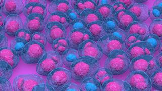 Σημαντική μελέτη για αντιμετώπιση ασθενών με πολλαπλούν μυέλωμα, με ελληνική συμμετοχή