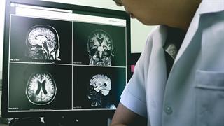 Η κατάθλιψη συνδέεται με 20% χαμηλότερα επίπεδα ταυρίνης στον ιππόκαμπο [μελέτη]