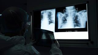 62 θάνατοι ασθενών με CoViD - 37% πάνω οι νοσηλείες, 54 διασωληνωμένοι