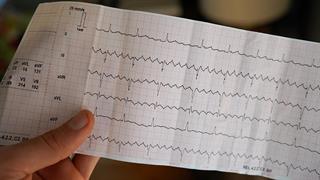 Αυξήθηκαν ή μειώθηκαν τα καρδιαγγειακά επεισόδια κατά τη διάρκεια της πανδημίας; 