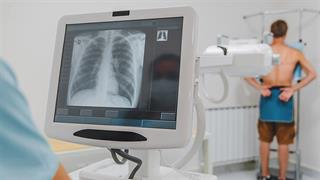 Η Medison Pharma  αναλαμβάνει την αποκλειστικότητα στην εμπορική διάθεση του  cemiplimab