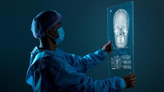 Πειραματικό φάρμακο είναι πιθανό να μειώνει τον κίνδυνο επαναλαμβανόμενων εγκεφαλικών [μελέτη]