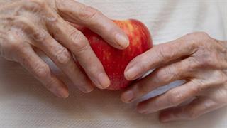 Σαρκοπενία: Τι είναι και πώς αντιμετωπίζεται