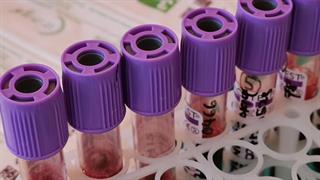 'Εγκριση της πρώτης γονιδιακής θεραπείας για τη δρεπανοκυτταρική νόσο και την εξαρτώμενη από μετάγγιση β-θαλασσαιμία