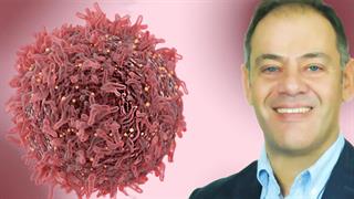 Αθ. Τραγιαννίδης: Τέσσερα στα πέντε παιδιά με καρκίνο επιβιώνουν