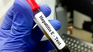 Πώς αντιμετωπίζεται η ηπατίτιδα Ε