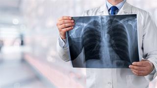 Πνευμονία από εισρόφηση: Ποιες καταστάσεις συνδέονται με αυτήν