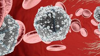Ολλανδία: Πώς αφαιρέθηκε ο ιός του AIDS από τα μολυσμένα κύτταρα