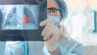 Καρκίνος: Αύξηση των περιστατικών κατά 77% παγκοσμίως έως το 2050 [μελέτη] 