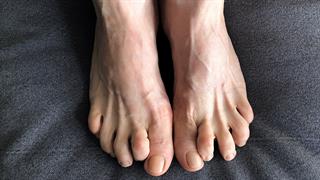 Προβλήματα των ποδιών που εμφανίζονται όσο μεγαλώνουμε