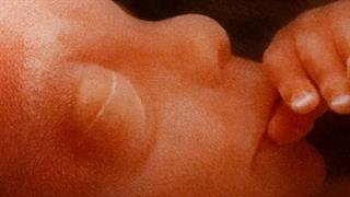 Η πίεση στη μήτρα επηρεάζει τον σχηματισμό των χαρακτηριστικών του προσώπου [μελέτη]