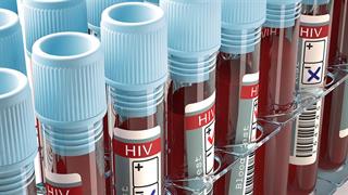 Ένα βήμα πιο κοντά στην ανάπτυξη αποτελεσματικού εμβολίου για τον HIV