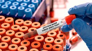 Φάρμακο για την πρόληψη καρκίνου από τον ιό Epstein - Barr