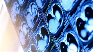 Μούμιες δείχνουν οτι η καρδιοπάθεια δεν αφορά μόνο τον σύγχρονο άνθρωπο