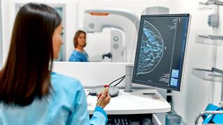 Νέα δεδομένα από πρωτοποριακή θεραπεία για τον ορμονοευαίσθητο καρκίνο μαστού