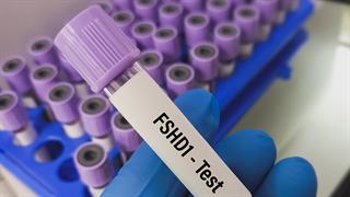 Θετικά αποτελέσματα από μελέτη για την προσωπο-ωμο-βραχιόνιο μυϊκή δυστροφία