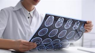 Εγκρίθηκε στην Ευρωπαϊκή Ένωση σκεύασμα για την  πολλαπλή σκλήρυνση