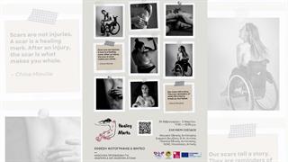 Healing Marks: Η δύναμη της αυτοαποδοχής και η κατάρριψη στιγματιστικών προτύπων ομορφιάς