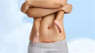 Το σώμα μου μετά τη γέννα: Αυτοφροντίδα χωρίς ενοχές