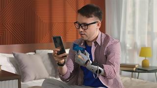 Ο εγκέφαλος δεν ξεχνά το χέρι μετά τον ακρωτηριασμό