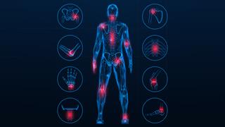 Σύνδρομο Catel-Manzke: Ερευνητική ομάδα αναζητά την αιτία του