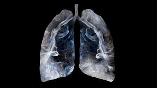 Γερμανικό κέντρο έρευνας για τον καρκίνο: Ένας στους επτά θανάτους οφείλεται στο κάπνισμα