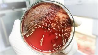 Η υπερ-κόλλα της φύσης: Οι σταφυλόκοκκοι προσκολλώνται στο δέρμα με δύναμη - ρεκόρ