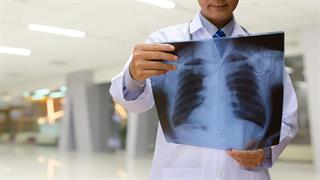 Διαφωνίες της ΕΕΠΕ στο υπό διαβούλευση νομοσχέδιο για τη Δημόσια Υγεία