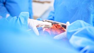 Πρώτη μεταμόσχευση ήπατος χοίρου σε άνθρωπο