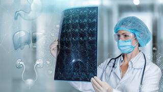 ΕΚΠΑ: Κλειδί η εξατομικευμένη θεραπεία στον καρκίνο του παγκρέατος