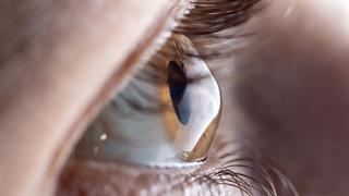 Ο FDA ενέκρινε νέα θεραπεία για  τον κερατόκωνο