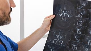 Όταν τα αιμοφόρα αγγεία γερνούν, γερνά και η καρδιά