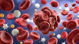 ΕΜΑ: Πρώτη γονιδιακή θεραπεία κατά της σπάνιας νόσου Wiskott - Aldrich