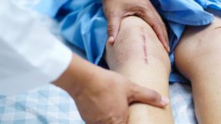 Πώς αντιμετωπίζουμε την ουλή στο δέρμα