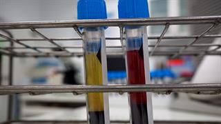 Αιμοποίηση: Δύο συστήματα με διαφορετικές αρμοδιότητες