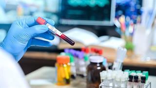 Πλαίσιο αποζημίωσης για τη διενέργεια των εργαστηριακών εξετάσεων του ιού HIV