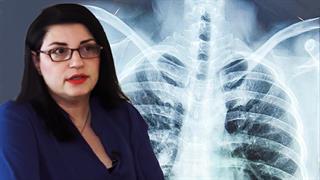 Η φυματίωση σήμερα - Στα σκαριά Εθνικό Σχέδιο από τον ΕΟΔΥ