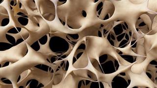 Σε ποιες περιπτώσεις και γιατί χρειάζεται ρευματολόγος 